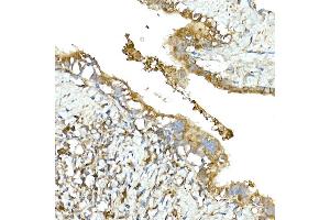 Immunohistochemistry of paraffin-embedded rat lung using LGR5/GPR49 Rabbit pAb  at dilution of 1:300 (40x lens).