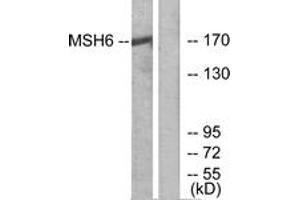 Western blot analysis of extracts from HuvEc cells, using MSH6 Antibody.