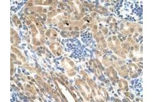 Image no. 1 for anti-Indian Hedgehog (IHH) (AA 24-73) antibody (ABIN205075)