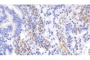 Detection of IL17 in Rabbit Small intestine Tissue using Monoclonal Antibody to Interleukin 17 (IL17)