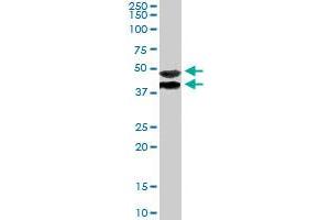 TRIM54 polyclonal antibody  staining (1ug/ml) of human muscle lysate (RIPA buffer, 35ug total protein per lane) . (TRIM54 anticorps)
