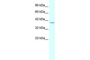 Human Daudi; WB Suggested Anti-HMX1 AntibodyTitration: 5. (HMX1 anticorps  (Middle Region))