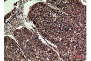 Immunohistochemistry (IHC) analysis of paraffin-embedded Human Lung, antibody was diluted at 1:100.