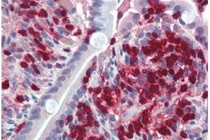 Human Small Intestine (formalin-fixed, paraffin-embedded) stained with S100A4 antibody ABIN337109 at 2. (s100a4 anticorps  (AA 86-98))
