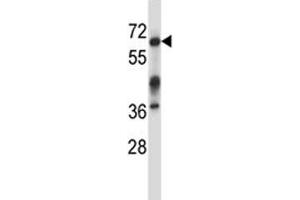 Irak3 antibody western blot analysis in mouse kidney tissue lysate.