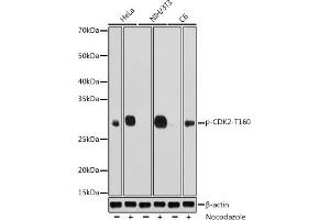 Western blot analysis of extracts of various cell lines, using Phospho-CDK2-T160 antibody (ABIN3020138, ABIN3020139, ABIN3020140, ABIN1681460 and ABIN1681461) at 1:1000 dilution. (CDK2 anticorps  (pThr160))