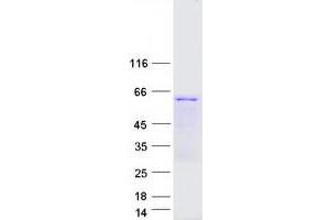 Validation with Western Blot