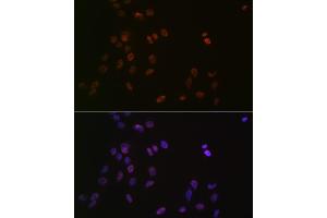 Immunofluorescence analysis of C6 cells using L Rabbit mAb (ABIN7270266) at dilution of 1:100 (40x lens).