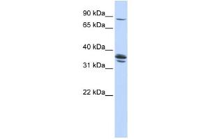 Western Blotting (WB) image for anti-Solute Carrier Organic Anion Transporter Family, Member 3A1 (SLCO3A1) antibody (ABIN2458794) (Solute Carrier Organic Anion Transporter Family, Member 3A1 (SLCO3A1) anticorps)