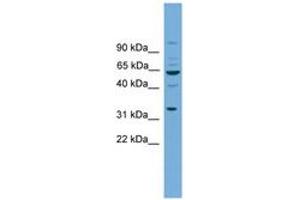 Image no. 1 for anti-Wingless-Type MMTV Integration Site Family, Member 8B (WNT8B) (AA 71-120) antibody (ABIN6745608)