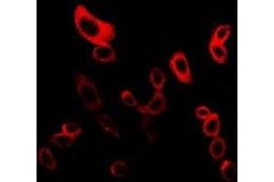 Immunofluorescent analysis of mPR gamma staining in LOVO cells. (PAQR5 anticorps  (C-Term))