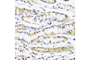 Immunohistochemistry of paraffin-embedded human stomach using GNRH1 antibody at dilution of 1:100 (40x lens). (GNRH1 anticorps)