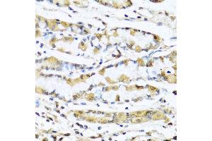 Immunohistochemistry of paraffin-embedded human stomach using GNRH1 antibody at dilution of 1:100 (40x lens).