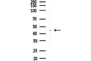 anti-F-Box Protein 4 (FBXO4) antibody