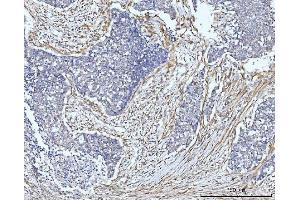 IHC analysis of FHL2 using anti-FHL2 antibody (ABIN7600782). (FHL2 anticorps  (AA 234-279))