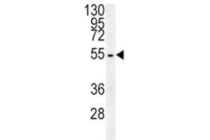 Beta III Tubulin antibody western blot analysis in HepG2 lysate