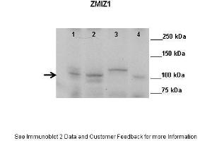 Lanes:   Lane 1: 50ug mouse retina extract Lane 2: 50ug mouse prostate extract Lane 3: 50ug mouse testis extract Lane 4: 50ug mouse colon extract  Primary Antibody Dilution:    1:1000  Secondary Antibody:   Anti-rabbit HRP  Secondary Antibody Dilution:    1:10,000  Gene Name:   ZMIZ1  Submitted by:   John Fu, UVA