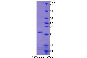 SDS-PAGE (SDS) image for Calcitonin Receptor (CALCR) (AA 42-170) protein (His tag) (ABIN6238972)
