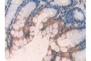 Detection of ANGPTL2 in Mouse Colon Tissue using Polyclonal Antibody to Angiopoietin Like Protein 2 (ANGPTL2)