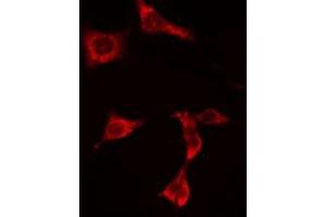 ABIN6274936 staining  HuvEc cells by IF/ICC.