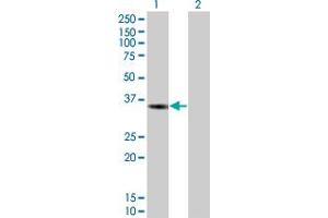 Lane 1: DCK transfected lysate ( 28. (DCK 293T Cell Transient Overexpression Lysate(Denatured))