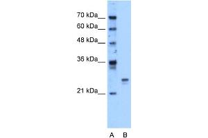 WB Suggested Anti-HMGB1 Antibody Titration:  1. (HMGB1 anticorps  (Middle Region))