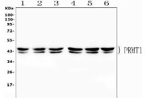 Western blot analysis of PRMT1 using anti-PRMT1 antibody (ABIN7599706).