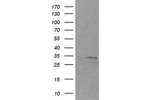 Image no. 1 for anti-Retinoic Acid Receptor Responder (Tazarotene Induced) 1 (RARRES1) antibody (ABIN1500602)