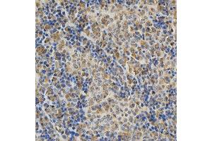 Immunohistochemistry (IHC) image for anti-DNA (Cytosine-5-)-Methyltransferase 3 alpha (DNMT3A) (AA 500-700) antibody (ABIN3022834) (DNMT3A anticorps  (AA 500-700))