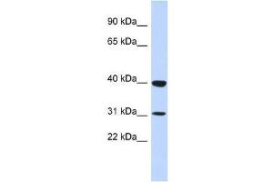 ZNF660 antibody used at 5 ug/ml to detect target protein. (ZNF660 anticorps  (N-Term))