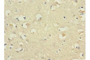 Immunohistochemistry of paraffin-embedded human brain tissue using ABIN7146199 at dilution of 1:100