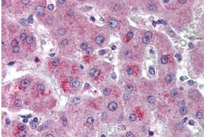Human Liver (formalin-fixed, paraffin-embedded) stained with HTRA3 antibody ABIN296848 at 10 ug/ml followed by biotinylated goat anti-rabbit IgG secondary antibody ABIN481713, alkaline phosphatase-streptavidin and chromogen. (HTRA3 anticorps  (AA 250-300))