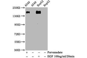Western Blot Positive WB detected in A549 whole cell lysate 72epG2 whole cell lysate(treated with EGF or Pervanadate) All lanes Phospho-EGFR antibody at 1. (Recombinant EGFR anticorps  (pTyr1068))
