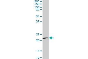 IL20 monoclonal antibody (M01), clone 2H8.