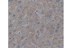 Used in DAB staining on fromalin fixed paraffin- embedded liver tissue