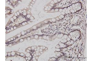Immunoperoxidase of monoclonal antibody to GABPA on formalin-fixed paraffin-embedded human small Intestine. (GABPA anticorps  (AA 1-100))