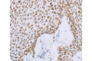 Immunohistochemistry (IHC) image for anti-Minichromosome Maintenance Complex Component 2 (MCM2) antibody (ABIN2428398) (MCM2 anticorps)