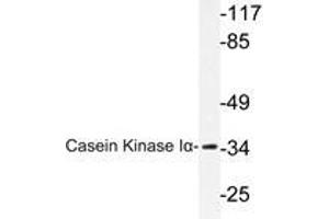 Western blot analysis of Casein Kinase I α antibody in extracts from HuvEc cells. (CSNK1A1 anticorps)