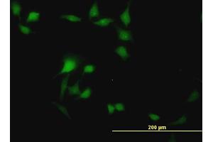 Immunofluorescence of monoclonal antibody to BOLL on HeLa cell.