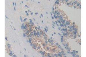 DAB staining on IHC-P; Samples: Human Prostate Tissue