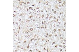 Immunohistochemistry of paraffin-embedded mouse liver using Phospho-c-Abl-Y412 antibody (ABIN7265966) at dilution of 1:100 (40x lens).