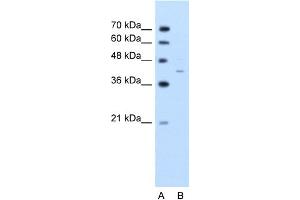 WB Suggested Anti-GNAS Antibody Titration:  2. (GNAS anticorps  (C-Term))