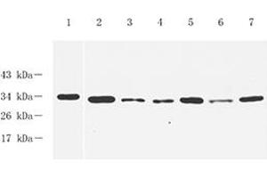 Western blot analysis of GTF2F2,(ABIN7074036) at dilution of 1: 1000,Lane 1: PC3 cell lysate,Lane 2: Mouse spleen tissue lysate,Lane 3: Mouse lung tissue lysate,Lane 4: Mouse testis tissue lysate,Lane 5: Rat spleen tissue lysate,Lane 6: Rat lung tissue lysate,Lane 7: Rat testis tissue lysate (GTF2F2 anticorps)