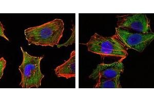 Immunofluorescence analysis of U251 (left) and NTERA2 (right) cells using CRTC1 antibody (green). (CRTC1 anticorps)