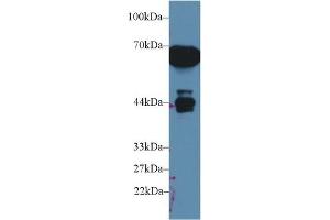 Western Blot; Sample: Rat Serum; Primary Ab: 1µg/ml Rabbit Anti-Rat a1M Antibody Second Ab: 0.