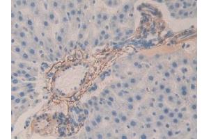 Detection of FBN1 in Rat Liver Tissue using Polyclonal Antibody to Fibrillin 1 (FBN1)