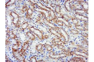 Paraformaldehyde-fixed, paraffin embedded rat kidney, Antigen retrieval by boiling in sodium citrate buffer (pH6) for 15min, Block endogenous peroxidase by 3% hydrogen peroxide for 30 minutes, Blocking buffer (normal goat serum) at 37°C for 20min, Antibody incubation with RPS6KB1(Ser441+Thr444) Antibody, Unconjugated  at 1:200 overnight at 4°C, followed by a conjugated secondary and DAB staining.