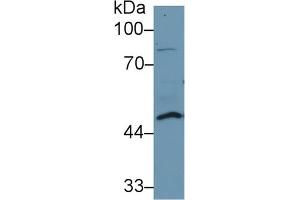 Western Blot; Sample: Human Lung lysate; ;Primary Ab: 1µg/ml Rabbit Anti-Human DDOST Antibody;Second Ab: 0.