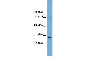 WB Suggested Anti-ZNF37A Antibody Titration:  0. (ZNF37A anticorps  (Middle Region))