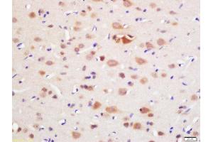 Formalin-fixed and paraffin embedded rat brain labeled with Rabbit Anti-DAL1 Polyclonal Antibody, Unconjugated (ABIN761021) at 1:200 followed by conjugation to the secondary antibody and DAB staining (EPB41L3 anticorps)